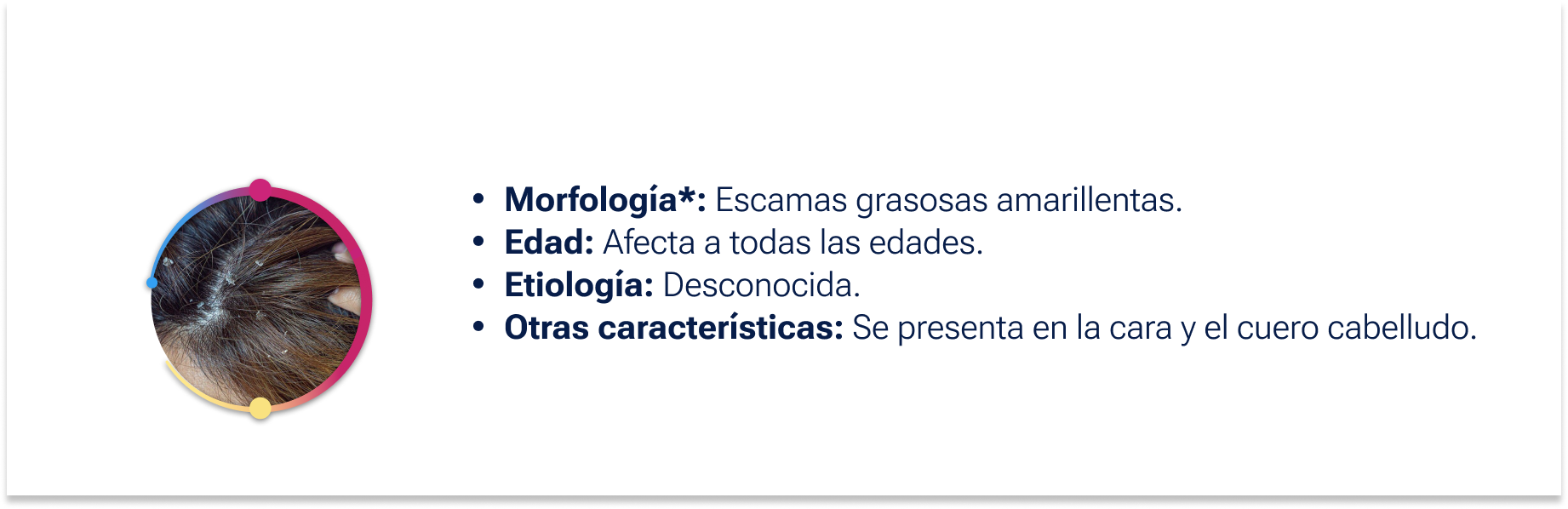 dermatitis seborreica